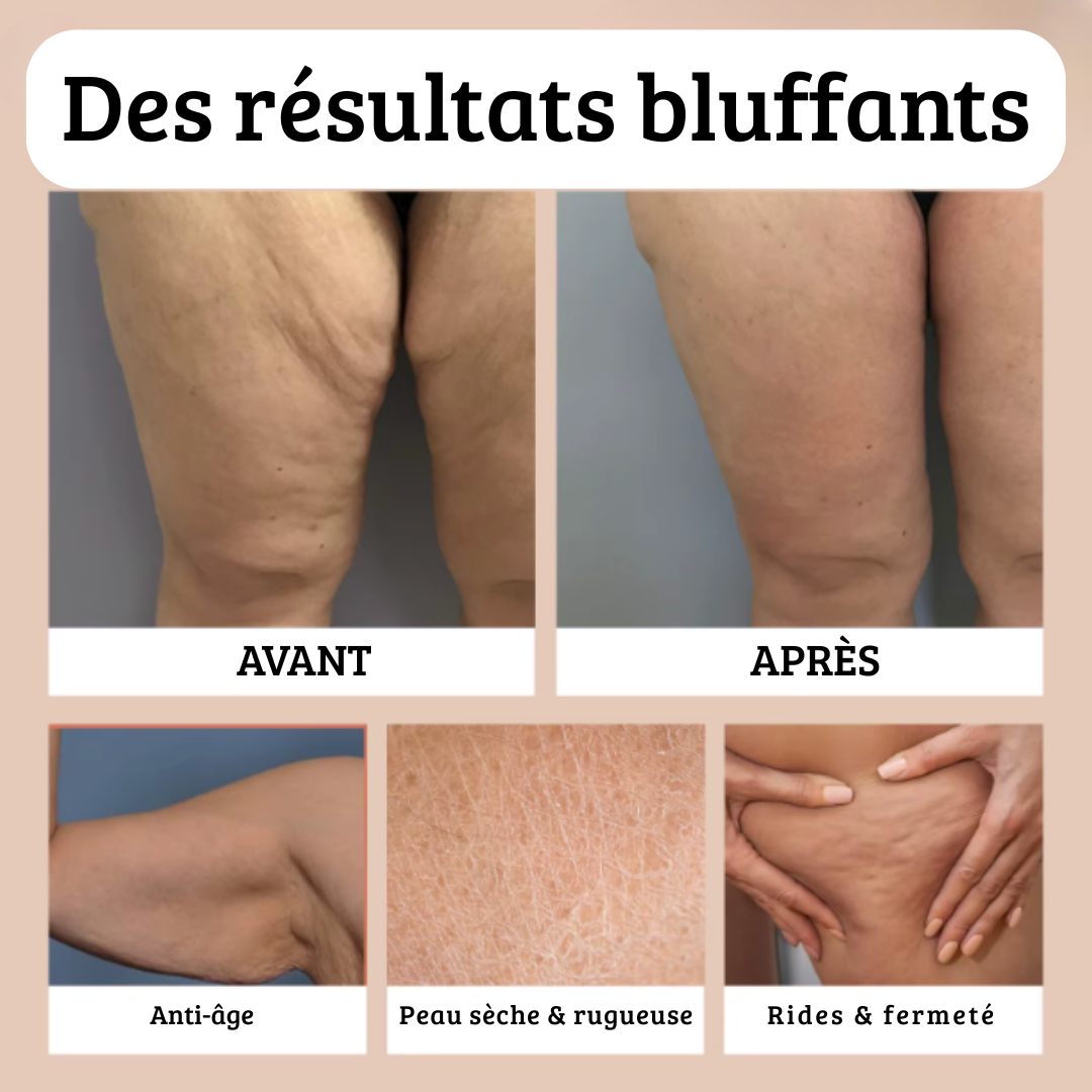 Huile Anti-Cellulite